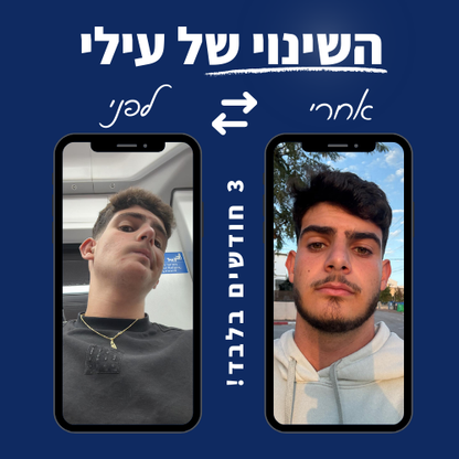 GrowUP - סרום לצמיחת שיער